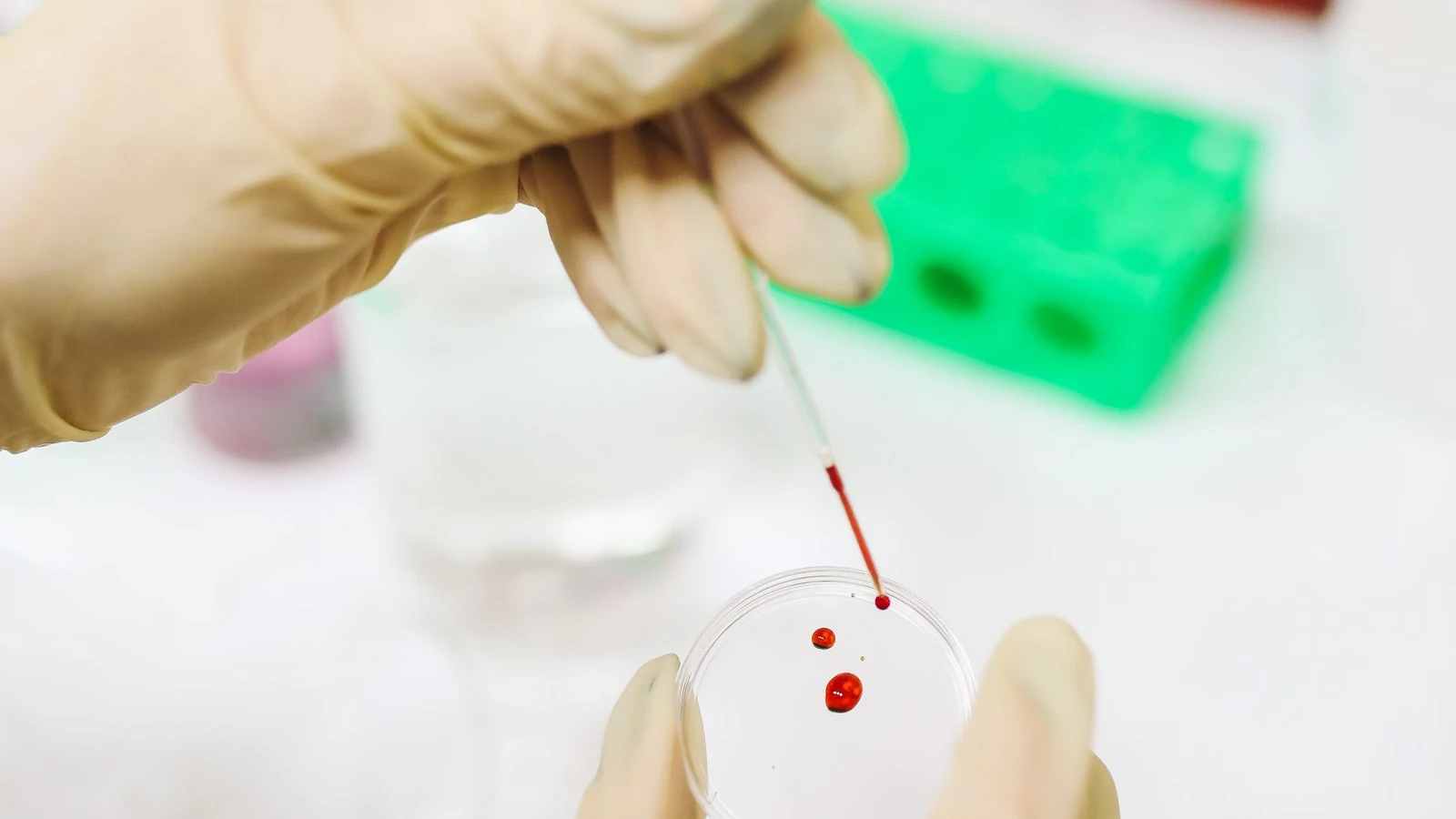 Unas manos con guantes manipulan una pipeta con líquido rojo sobre una placa transparente en un laboratorio.